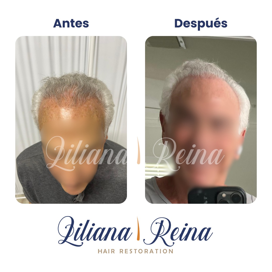 resultados-garantizados-cabello